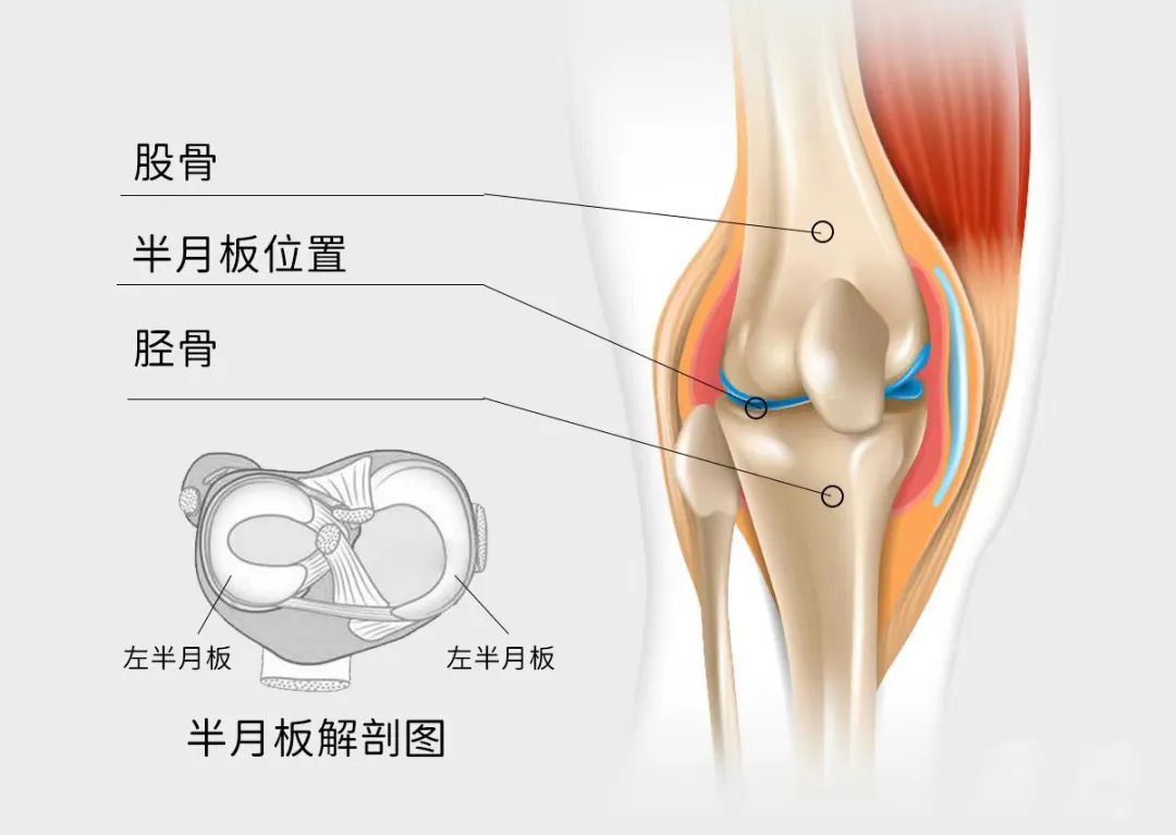 膝盖保卫战！我的三年跑步路，膝盖报废