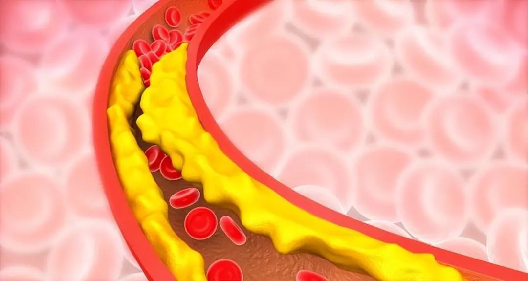 血脂到底怎么降？日常注意这8点！守护心血管健康