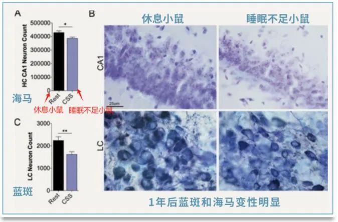 还敢熬夜吗？熬夜带来的这些伤害，都是完全不可逆的！