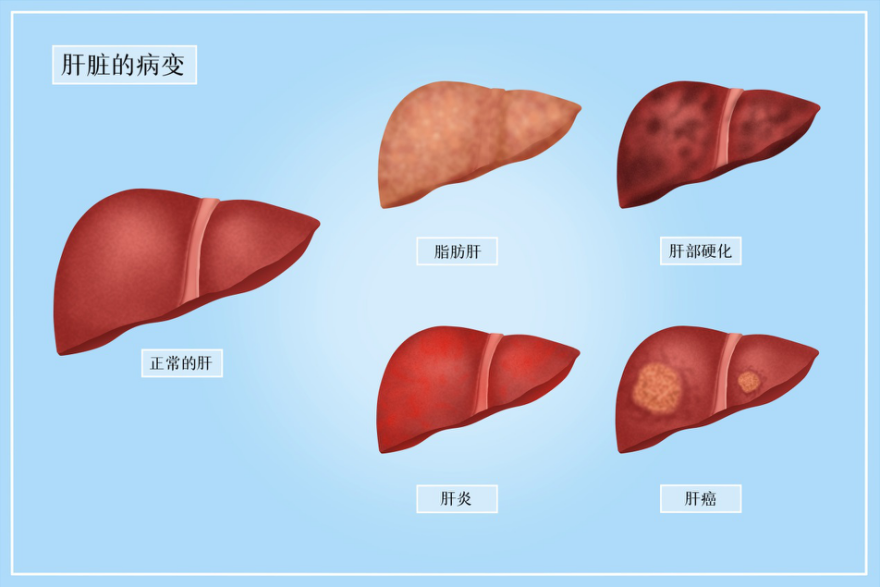 抗癌有道丨体重与癌症有关系吗？